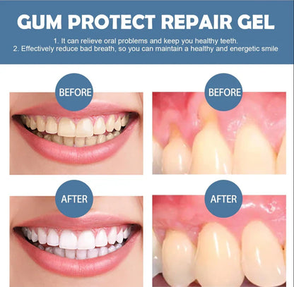【New upgrade】Caelvya Gum Protect Dental Repair Gel【3 tubes/box】