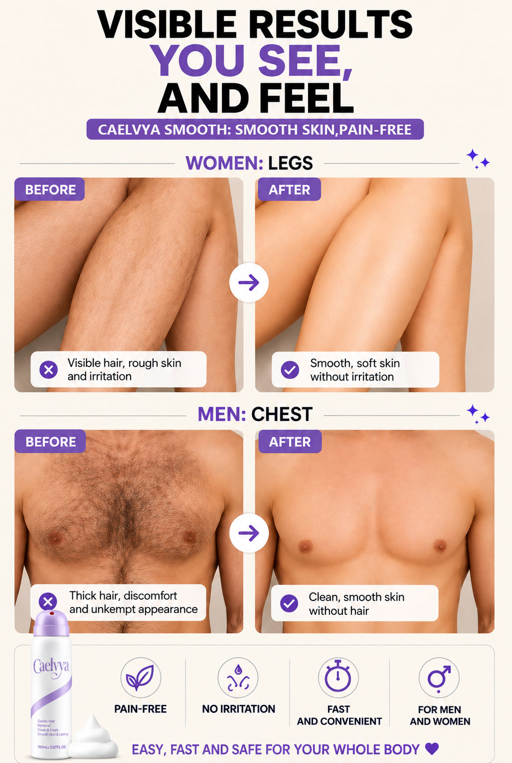 Caelvya Bikini Pain-Free Hair Removal Cream for Sensitive Skin