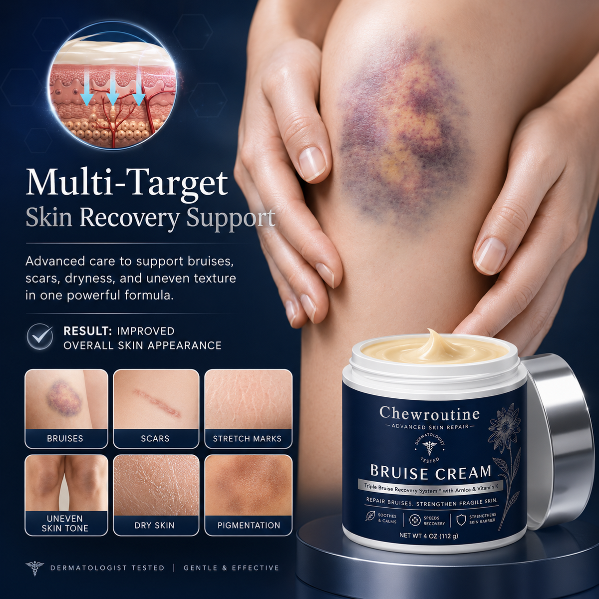 ChewRoutine® Bruise Repair & Skin-Strengthening Cream