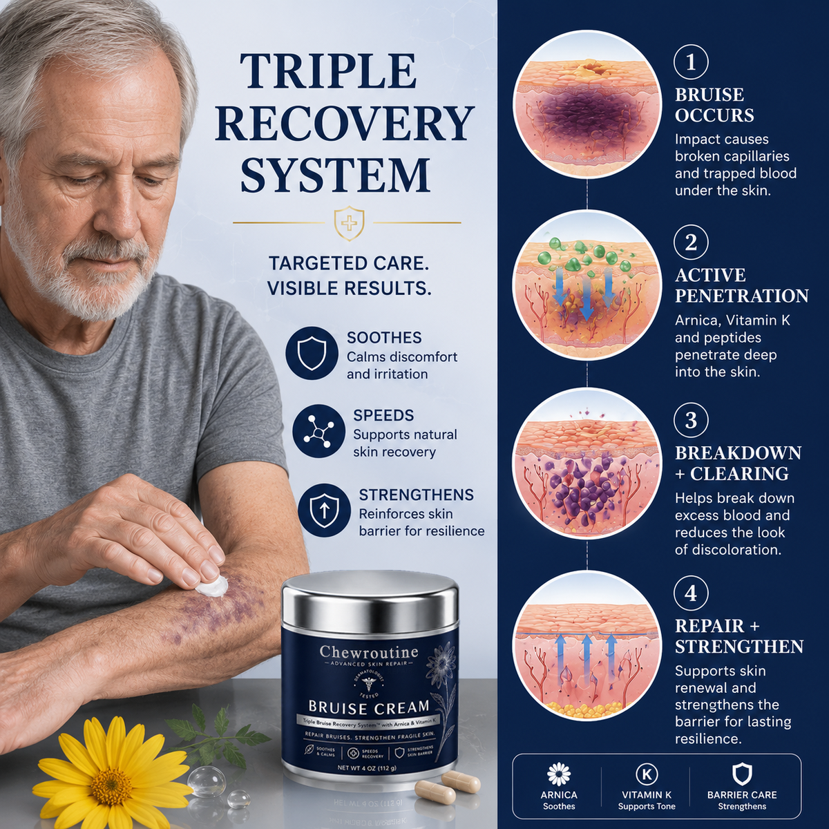 ChewRoutine® Bruise Repair & Skin-Strengthening Cream
