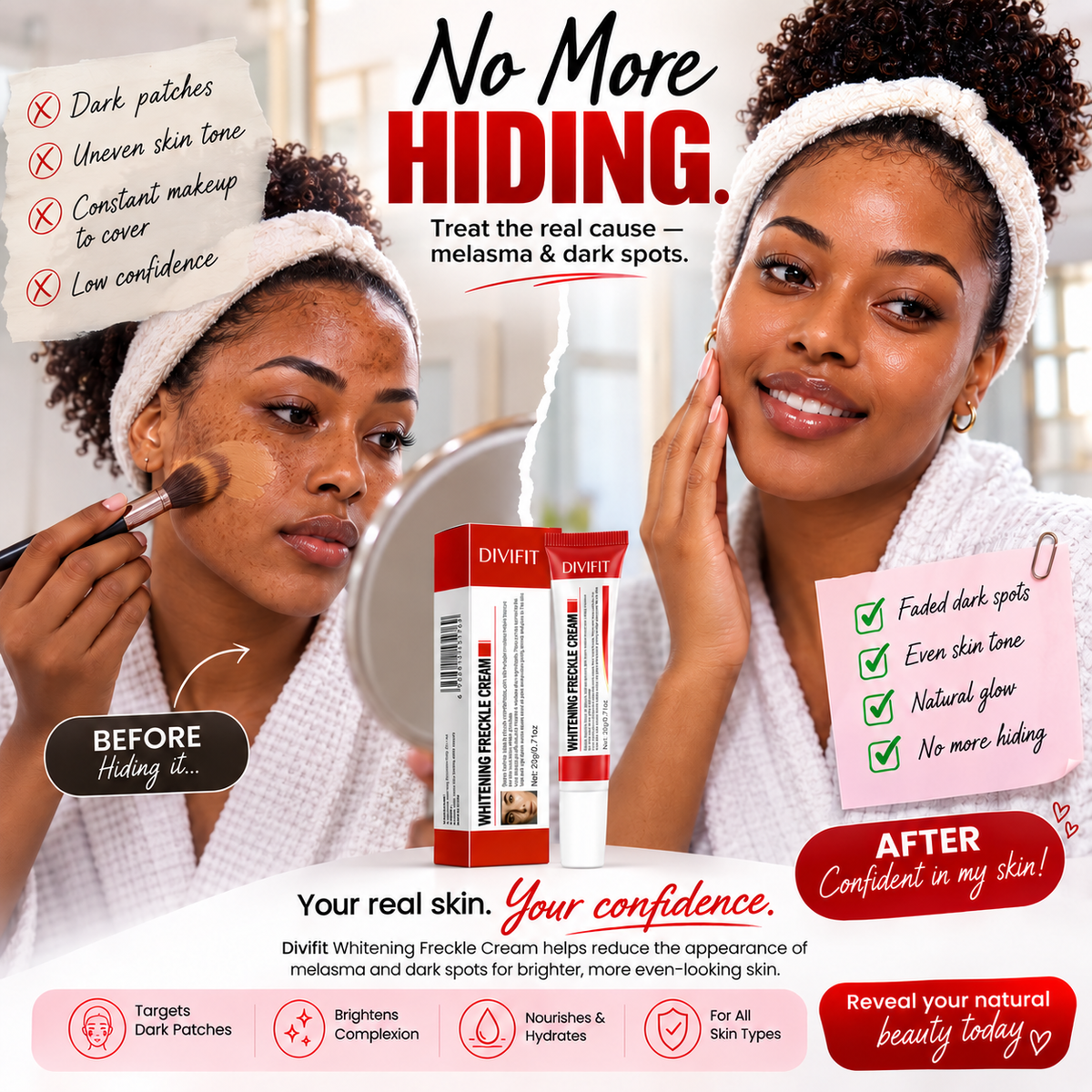 Melasma, Freckles and Dark spot Removal Cream