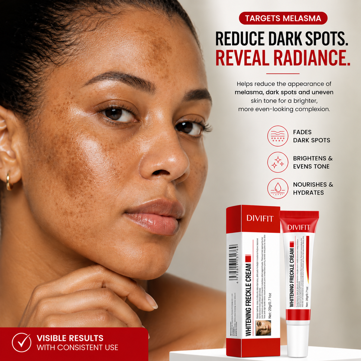 Melasma, Freckles and Dark spot Removal Cream