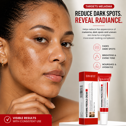 Melasma, Freckles and Dark spot Removal Cream