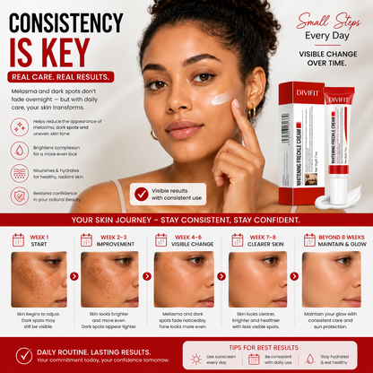 Melasma, Freckles and Dark spot Removal Cream