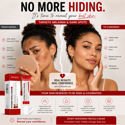 Melasma, Freckles and Dark spot Removal Cream