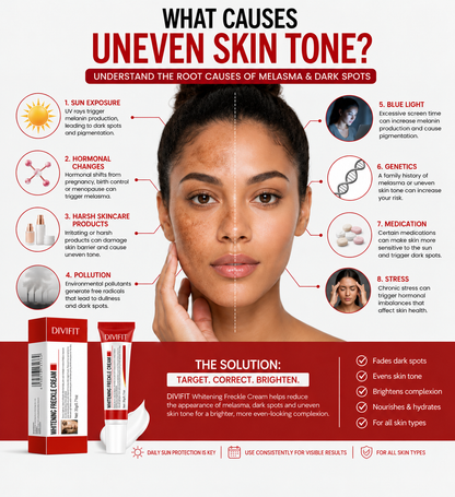 Melasma, Freckles and Dark spot Removal Cream